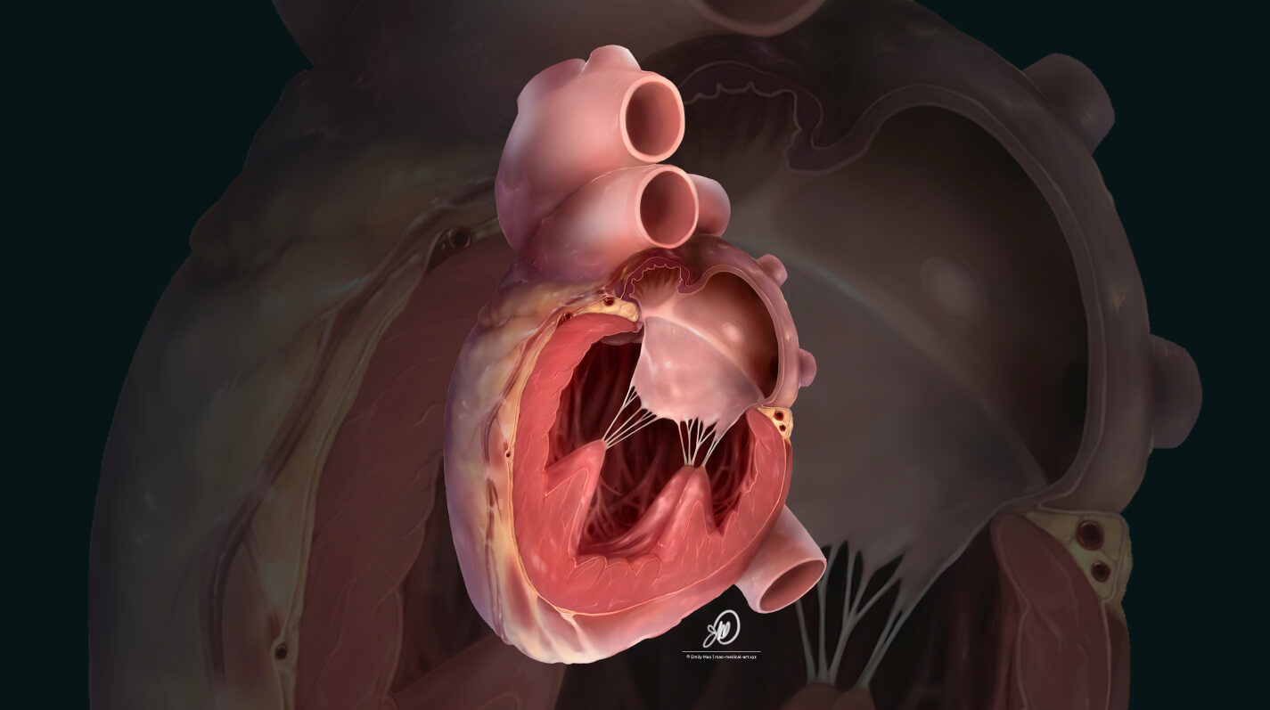 Cross-Section of a Human Heart